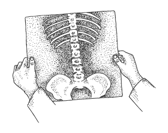 Back Pain Treatment - Queanbeyan & Canberra | Areté Chiropractic